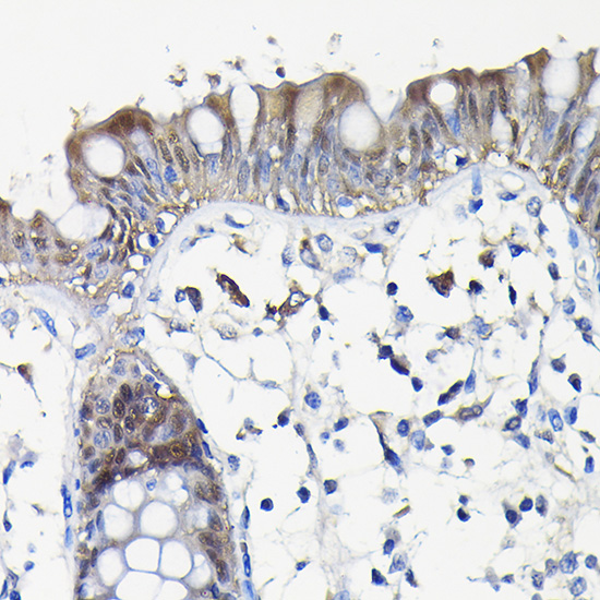 Immunohistochemistry of paraffin-embedded human colon using Galectin 3/Galectin 3/LGALS3 Polyclonal Antibody at dilution of 1:100 (40x lens).Perform high pressure antigen retrieval with 10 mM citrate buffer pH 6.0 before commencing with IHC staining protocol.