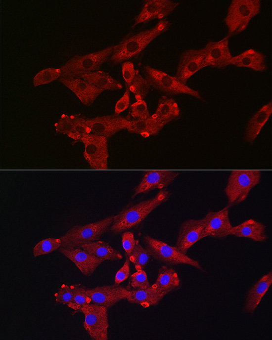 Immunofluorescence analysis of MG-63 cells using Osteocalcin Polyclonal Antibody at dilution of 1:200 (40x lens). Blue: DAPI for nuclear staining.