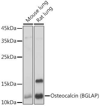 Western blot analysis of extracts of various cell lines using Osteocalcin Polyclonal Antibody at 1:1000 dilution.