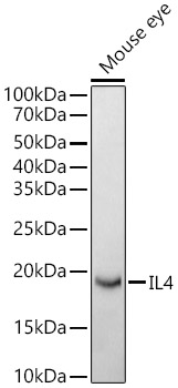 Western blot analysis of extracts of Mouse eye using IL4 Polyclonal Antibody at 1:700 dilution.