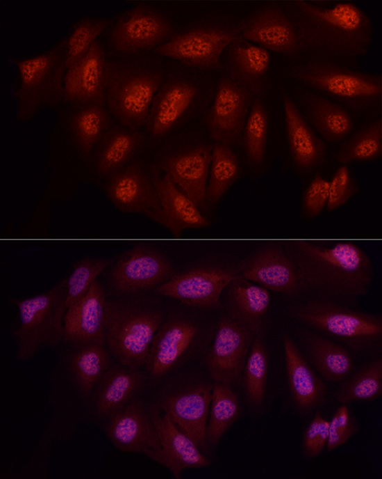 Immunofluorescence analysis of U2OS cells using WTAP Polyclonal Antibody at dilution of 1:50 (40x lens). Blue: DAPI for nuclear staining.