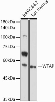Western blot analysis of extracts of various cell lines using WTAP  Polyclonal Antibody at 1:1000 dilution.