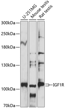Western blot analysis of extracts of various cell lines using IGF1R Polyclonal Antibody at 1:1000 dilution.