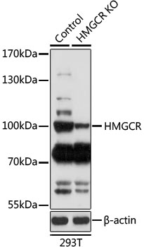 Western blot analysis of extracts of various cell lines using HMGCR Polyclonal Antibody at 1:1000 dilution.