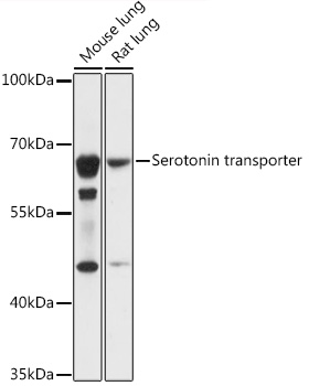 Western blot analysis of extracts of various cell lines using Serotonin transporter Polyclonal Antibody at 1:1000 dilution.