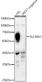 Western blot analysis of extracts of various cell lines using SLC40A1 Polyclonal Antibody at 1:400 dilution.