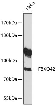 Western blot analysis of extracts of HeLa cells using FBXO42 Polyclonal Antibody at 1:1000 dilution.