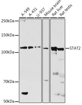 Western blot analysis of extracts of various cell lines using STAT2 Polyclonal Antibody at 1:500 dilution.