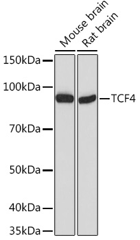 Western blot analysis of extracts of various cell lines using TCF4 Polyclonal Antibody at 1:1000 dilution.