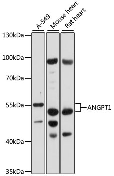 Western blot analysis of extracts of various cell lines using ANGPT1 Polyclonal Antibody at 1:1000 dilution.