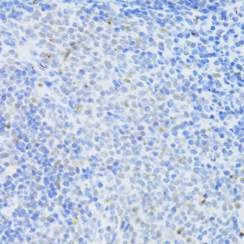 Immunohistochemistry of paraffin-embedded rat spleen using DNMT1 Polyclonal Antibody at dilution of 1:100 (40x lens).Perform microwave antigen retrieval with 10 mM PBS buffer pH 7.2 before commencing with IHC staining protocol.