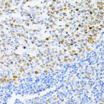 Immunohistochemistry of paraffin-embedded human tonsil using DNMT1 Polyclonal Antibody at dilution of 1:100 (40x lens).Perform microwave antigen retrieval with 10 mM PBS buffer pH 7.2 before commencing with IHC staining protocol.