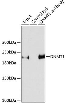 Immunoprecipitation analysis of 200ug extracts of HeLa cells using 3ug DNMT1 Polyclonal Antibody. Western blot was performed from the immunoprecipitate using DNMT1 Polyclonal Antibody at a dilution of 1:1000.