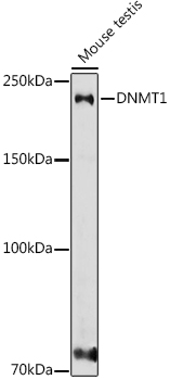 Western blot analysis of extracts of various cell lines using DNMT1 Polyclonal Antibody at 1:1000 dilution.