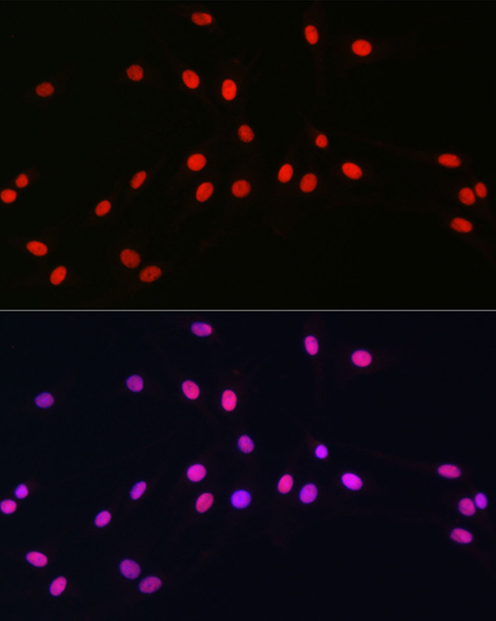 Immunofluorescence analysis of C6 cells using SOX10 Polyclonal Antibody at dilution of 1:100 (40x lens). Blue: DAPI for nuclear staining.