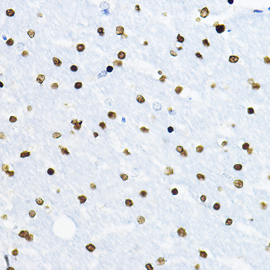 Immunohistochemistry of paraffin-embedded rat brain using SOX10 Polyclonal Antibody at dilution of 1:100 (40x lens).Perform high pressure antigen retrieval with 10 mM citrate buffer pH 6.0 before commencing with IHC staining protocol.