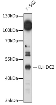 Western blot analysis of extracts of K-562 cells using KLHDC2 Polyclonal Antibody at 1:1000 dilution.