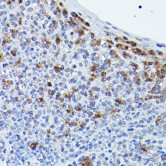 Immunohistochemistry of paraffin-embedded human tonsil using GPR109A/HM74A/HCAR2 Polyclonal Antibody at dilution of 1:20 (40x lens).Perform high pressure antigen retrieval with 10 mM citrate buffer pH 6.0 before commencing with IHC staining protocol.