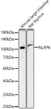 Western blot analysis of various lysates using NLRP6 Polyclonal Antibody at 1:400 dilution.
