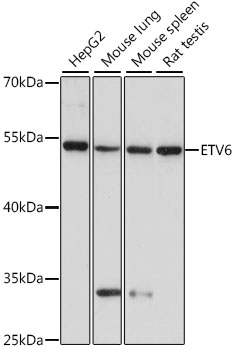 Western blot analysis of extracts of various cell lines using ETV6 Polyclonal Antibody at 1:1000 dilution.