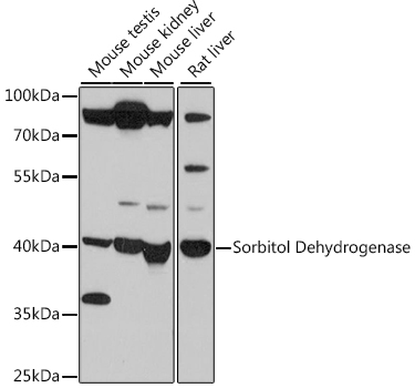 Western blot analysis of extracts of various cell lines using Sorbitol Dehydrogenase Polyclonal Antibody at 1:500 dilution.