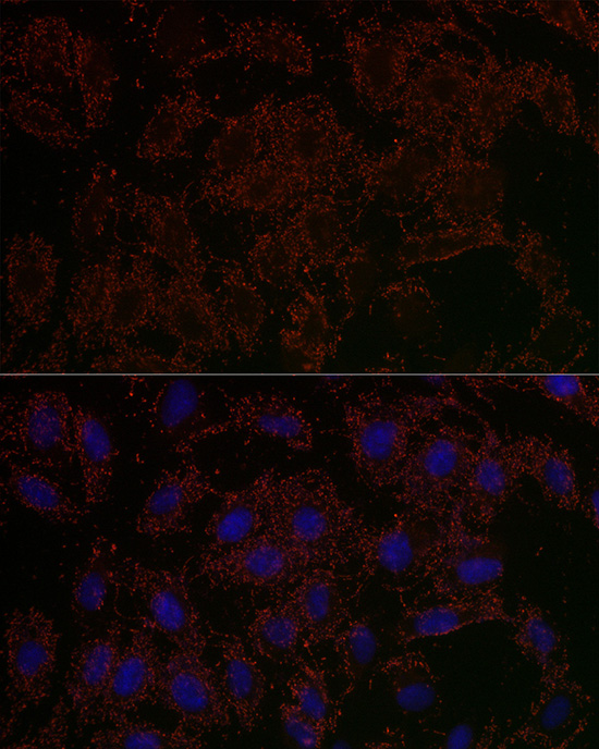 Immunofluorescence analysis of U2OS cells using GLS2 Polyclonal Antibody at dilution of 1:200 (40x lens). Blue: DAPI for nuclear staining.