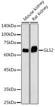 Western blot analysis of extracts of various cell lines using GLS2 Polyclonal Antibody at 1:1000 dilution.