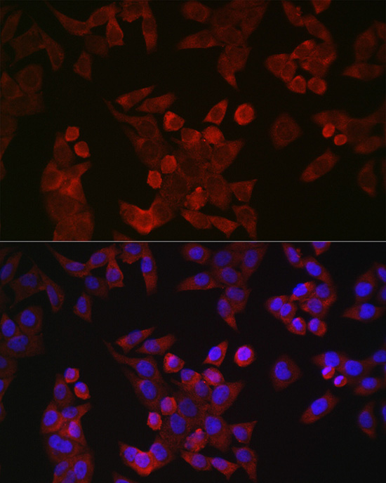 Immunofluorescence analysis of HeLa cells using Cyclin B1 Polyclonal Antibody at dilution of 1:100 (40x lens). Blue: DAPI for nuclear staining.