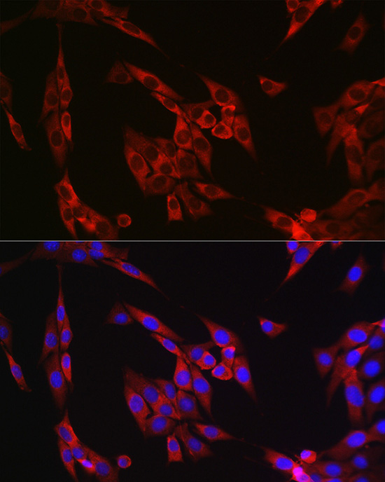 Immunofluorescence analysis of NIH/3T3 cells using Cyclin B1 Polyclonal Antibody at dilution of 1:100 (40x lens). Blue: DAPI for nuclear staining.