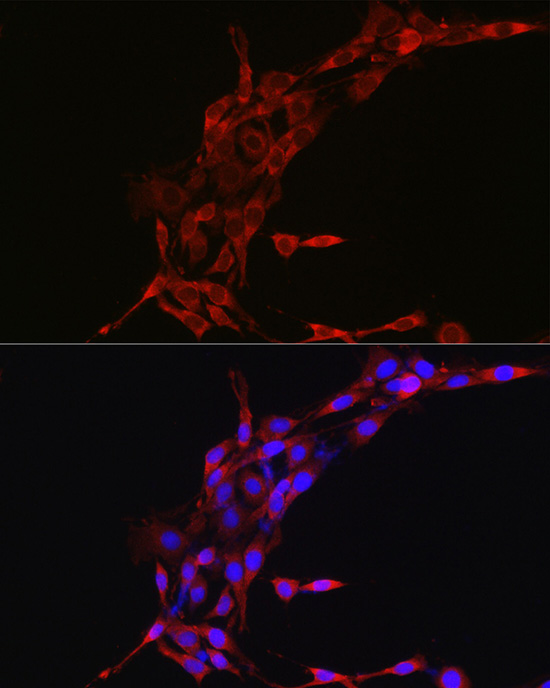 Immunofluorescence analysis of PC-12 cells using Cyclin B1 Polyclonal Antibody at dilution of 1:100 (40x lens). Blue: DAPI for nuclear staining.