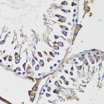 Immunohistochemistry of paraffin-embedded rat testis using Cyclin B1 Polyclonal Antibody at dilution of 1:100 (40x lens).Perform microwave antigen retrieval with 10 mM PBS buffer pH 7.2 before commencing with IHC staining protocol.