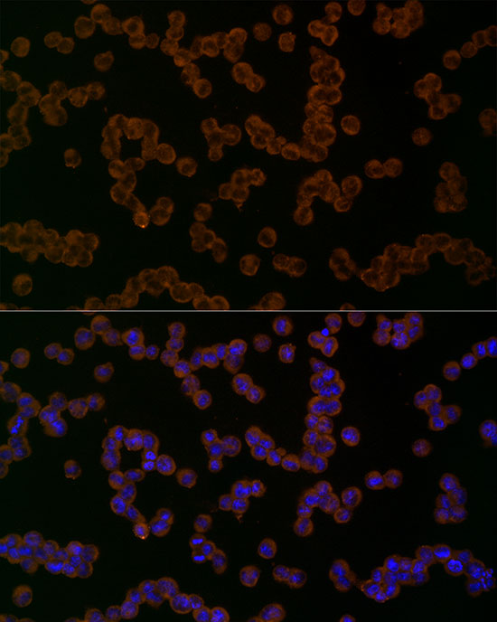 Immunofluorescence analysis of K-562 cells using NLRP1 Polyclonal Antibody at dilution of 1:50 (40x lens). Blue: DAPI for nuclear staining.