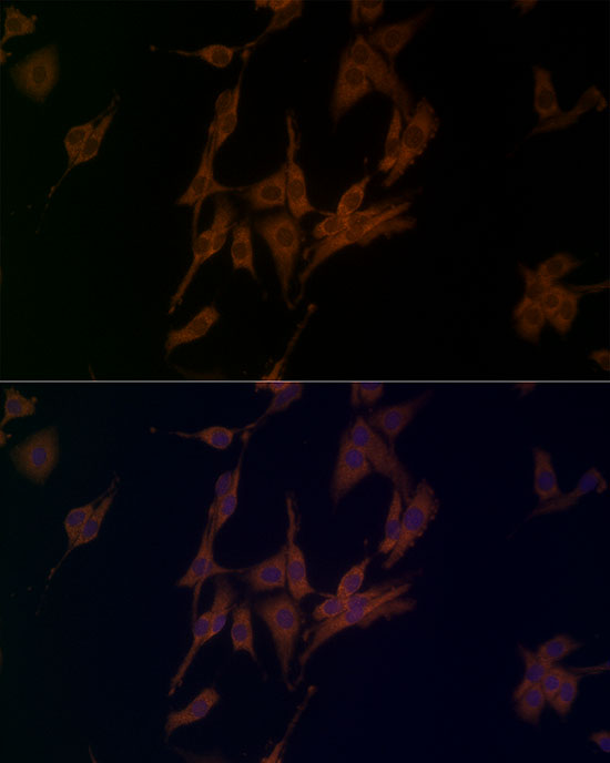 Immunofluorescence analysis of PC-12 cells using NLRP1 Polyclonal Antibody at dilution of 1:50 (40x lens). Blue: DAPI for nuclear staining.