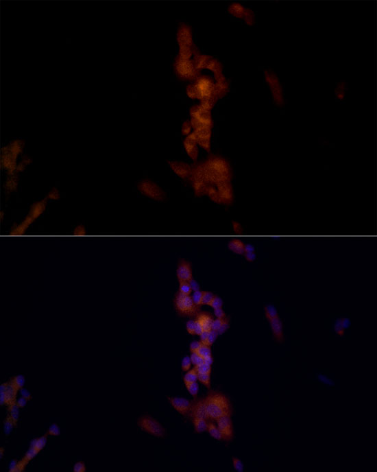 Immunofluorescence analysis of SH-SY5Y cells using NLRP1 Polyclonal Antibody at dilution of 1:50 (40x lens). Blue: DAPI for nuclear staining.