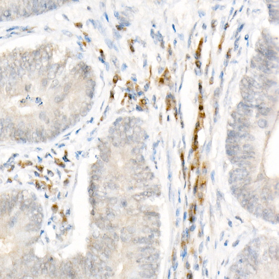 Immunohistochemistry of paraffin-embedded human colon using NLRP1 Polyclonal Antibody at dilution of 1:50 (40x lens).Perform high pressure antigen retrieval with 10 mM citrate buffer pH 6.0 before commencing with IHC staining protocol.