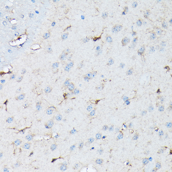 Immunohistochemistry of paraffin-embedded human tonsil using NLRP1 Polyclonal Antibody at dilution of 1:50 (40x lens).Perform high pressure antigen retrieval with 10 mM citrate buffer pH 6.0 before commencing with IHC staining protocol.