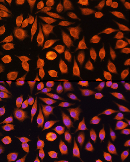 Immunofluorescence analysis of L929 cells using NF-kB p65/RelA Polyclonal Antibody at dilution of 1:100. Blue: DAPI for nuclear staining.