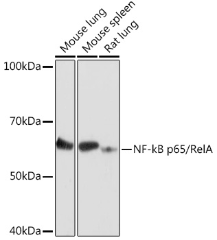 Western blot analysis of extracts of various cell lines using NF-kB p65/RelA Polyclonal Antibody at 1:500 dilution.