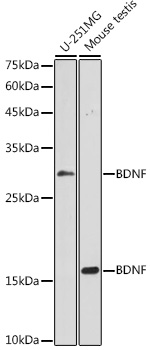 Western blot analysis of extracts of various cell lines using BDNF Polyclonal Antibody at 1:1000 dilution.