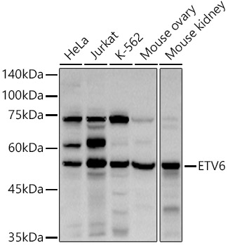 Western blot analysis of extracts of various cell lines using ETV6  Polyclonal Antibody at 1:1000 dilution.