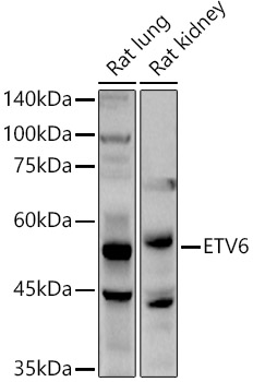 Western blot analysis of extracts of various cell lines using ETV6  Polyclonal Antibody at 1:1000 dilution.