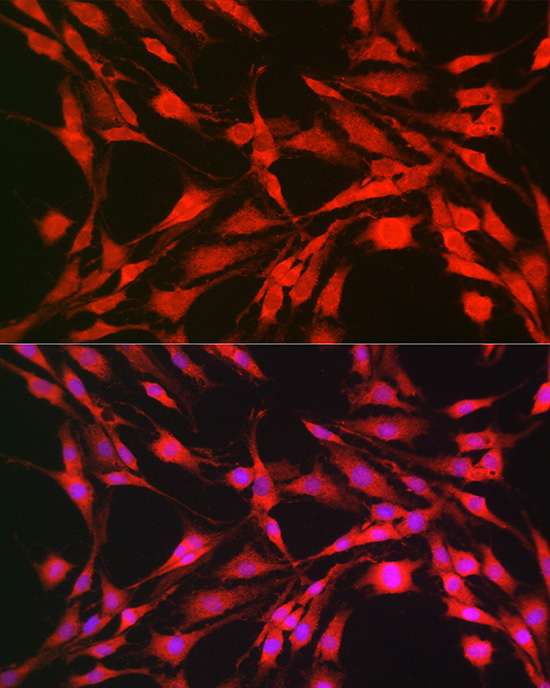 Immunofluorescence analysis of C6 cells using p70 S6 Kinase 1 Polyclonal Antibody at dilution of 1:100 (40x lens). Blue: DAPI for nuclear staining.