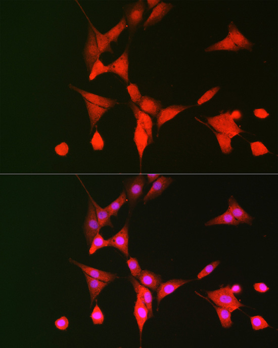 Immunofluorescence analysis of NIH/3T3 cells using p70 S6 Kinase 1 Polyclonal Antibody at dilution of 1:100 (40x lens). Blue: DAPI for nuclear staining.