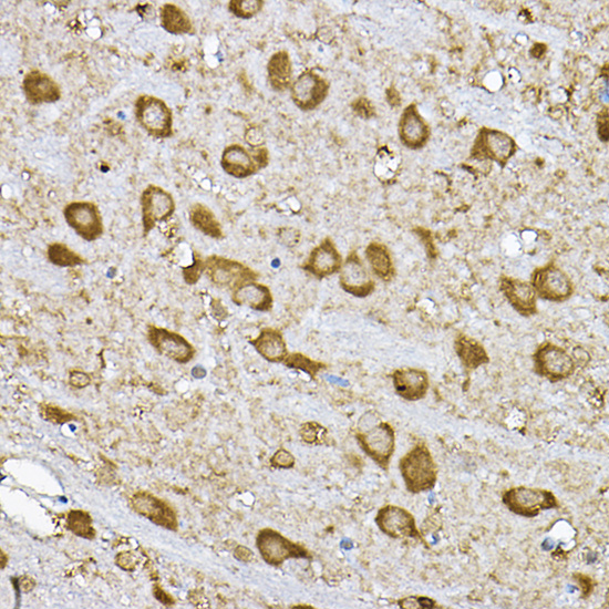 Immunohistochemistry of paraffin-embedded rat brain using p70 S6 Kinase 1 1 Polyclonal Antibody at dilution of 1:100 (40x lens).Perform high pressure antigen retrieval with 10 mM citrate buffer pH 6.0 before commencing with IHC staining protocol.