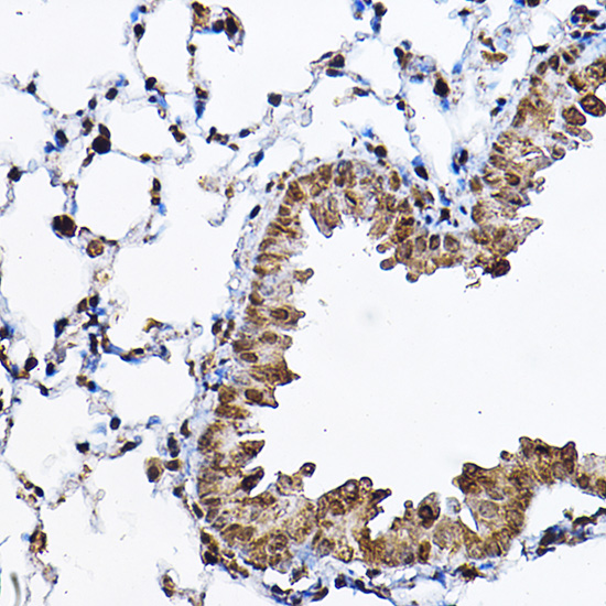 Immunohistochemistry of paraffin-embedded mouse lung using p70 S6 Kinase 1 1 Polyclonal Antibody at dilution of 1:100 (40x lens).Perform high pressure antigen retrieval with 10 mM citrate buffer pH 6.0 before commencing with IHC staining protocol.