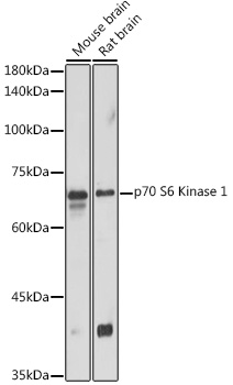 Western blot analysis of extracts of various cell lines using p70 S6 Kinase 1 1 Polyclonal Antibody at 1:1000 dilution.