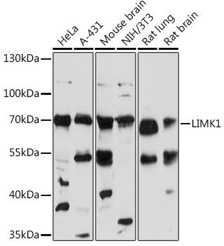 Western blot analysis of extracts of various cell lines using LIMK1 Polyclonal Antibody at 1:1000 dilution.