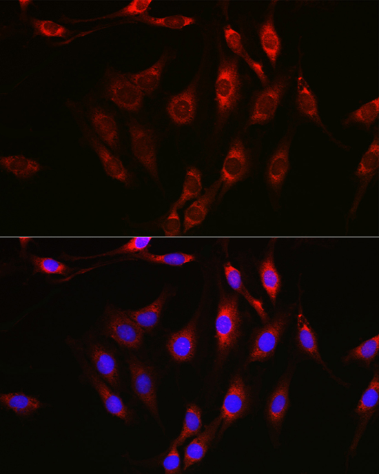 Immunofluorescence analysis of C6 using Notch1 Polyclonal Antibody at dilution of 1:100 (40x lens). Blue: DAPI for nuclear staining.