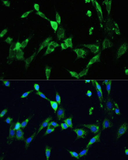 Immunofluorescence analysis of NIH/3T3 using VEGFA Polyclonal Antibody at dilution of 1:100. Blue: DAPI for nuclear staining.