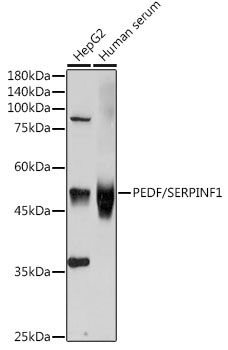 Western blot analysis of extracts of various cell lines using SERPINF1 Polyclonal Antibody at 1:1000 dilution.